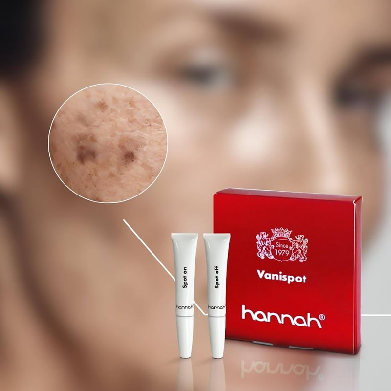 Hannah Vanispot Skin shop nl hannah-vanispot-skin-shop-nl