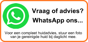 Vraag of advies via WhatsApp